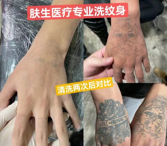 洗纹身前，必须知道及需注意什么事项