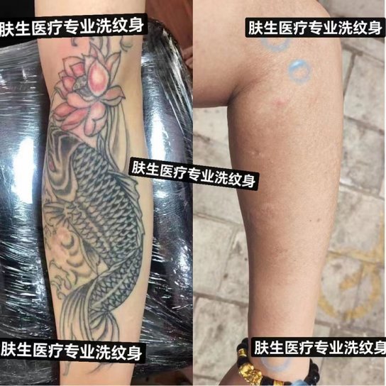 关于洗纹身，作为过来人给出几点建议